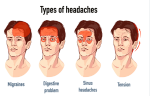 Types of Headaches